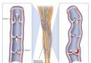 Nguyên nhân đau bắp chân, cách chẩn đoán và điều trị