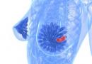Symptomen en behandeling van mastopathie van de borstklieren
