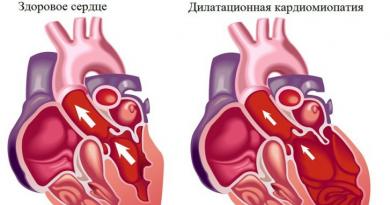 Apa itu kardiopati dan kardiomiopati pada anak-anak: penyebab, gejala dan pengobatan