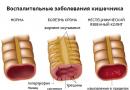 Nonspecific ulcerative colitis (NSA)
