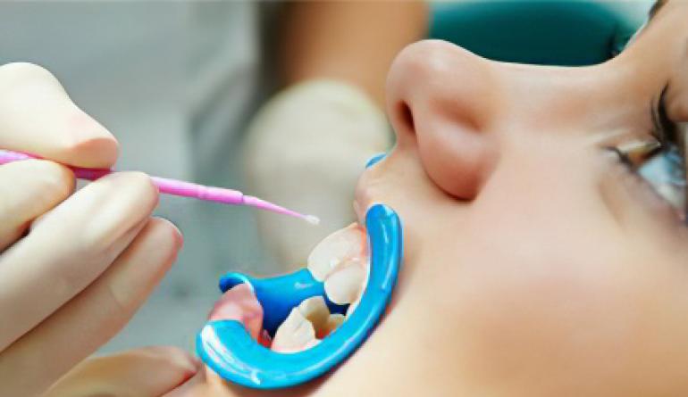 Cấu tạo, thành phần và chức năng của men răng Lớp men trên bề mặt răng là chất liệu bền nhất