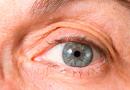 Какво трябва и какво не трябва да се прави след операция на катаракта