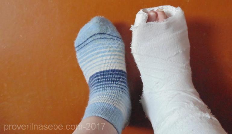 Колко време отнема заздравяването на счупен крак?